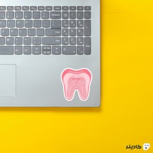 استیکر لپ تاپ استیکر لپ تاپ دندان‌پزشکی - دندان صورتی روی لپتاپ